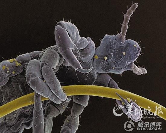 显微镜下的惊人<em>照片</em> 头虱极像蜘蛛<em>人</em>(图)-中华